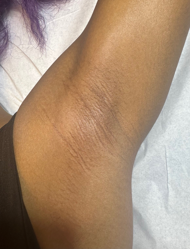 Underarm Wax at Luxury Lounge Esthetics in Washington Courthouse, OH