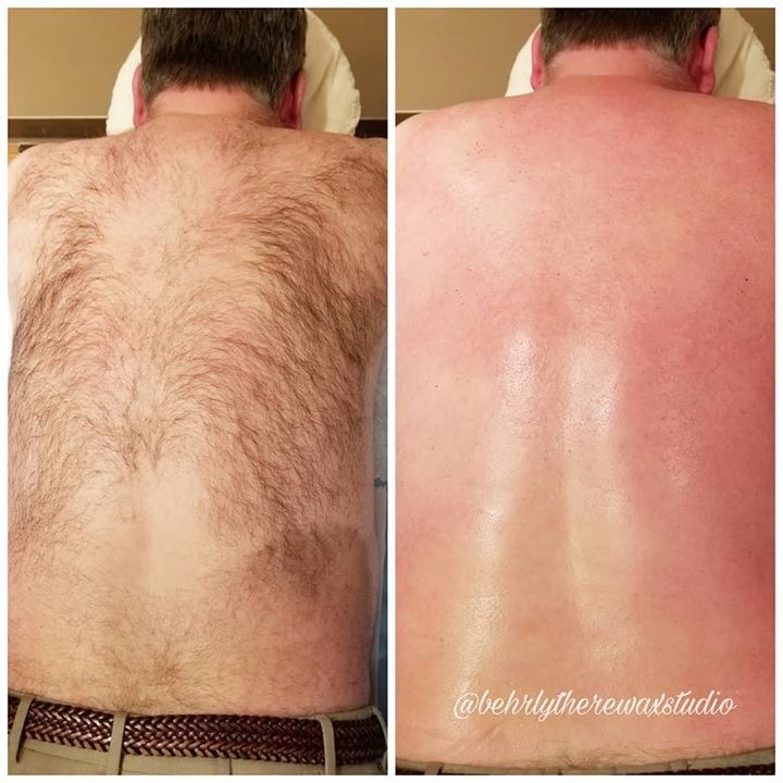 Chest And Back Wax
