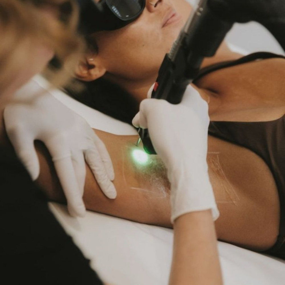 Laser Hair Removal • Under Arms at Cox Clinic & Aesthetics in Antlers, OK