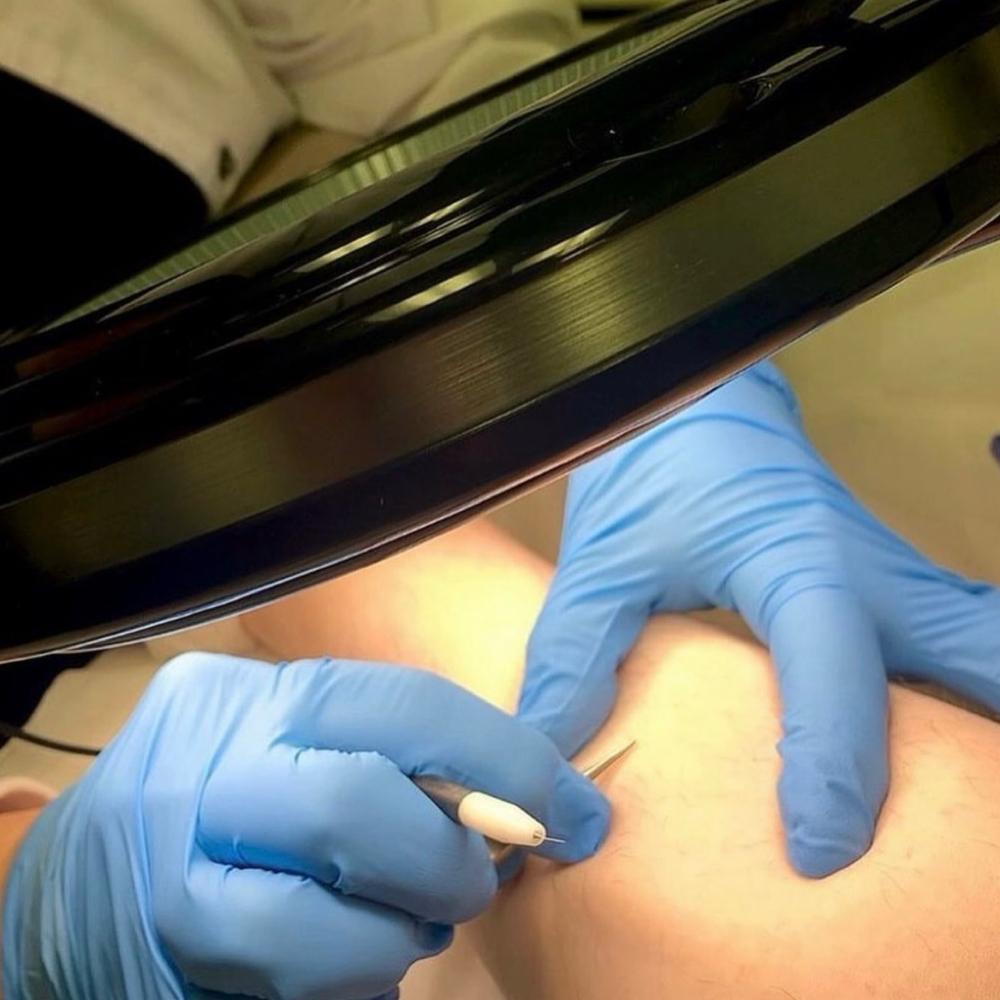 90 Minute Electrolysis Treatment at Accentuated Beauty Spa in Salisbury, NC