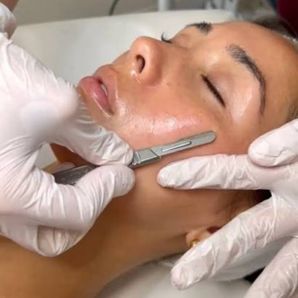 Dermaplaning at MGM Beauty Bar in Waterford, MI