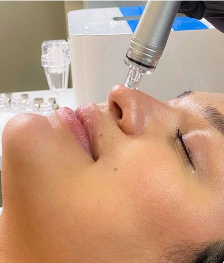 HydroDermabrasion/Hydro-Facials