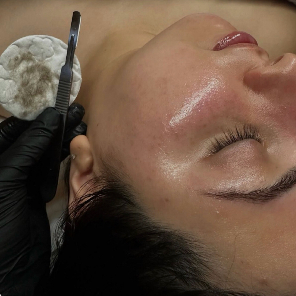 Get glowyy Dermaplane Facial at SKN by madison in Central Point, OR
