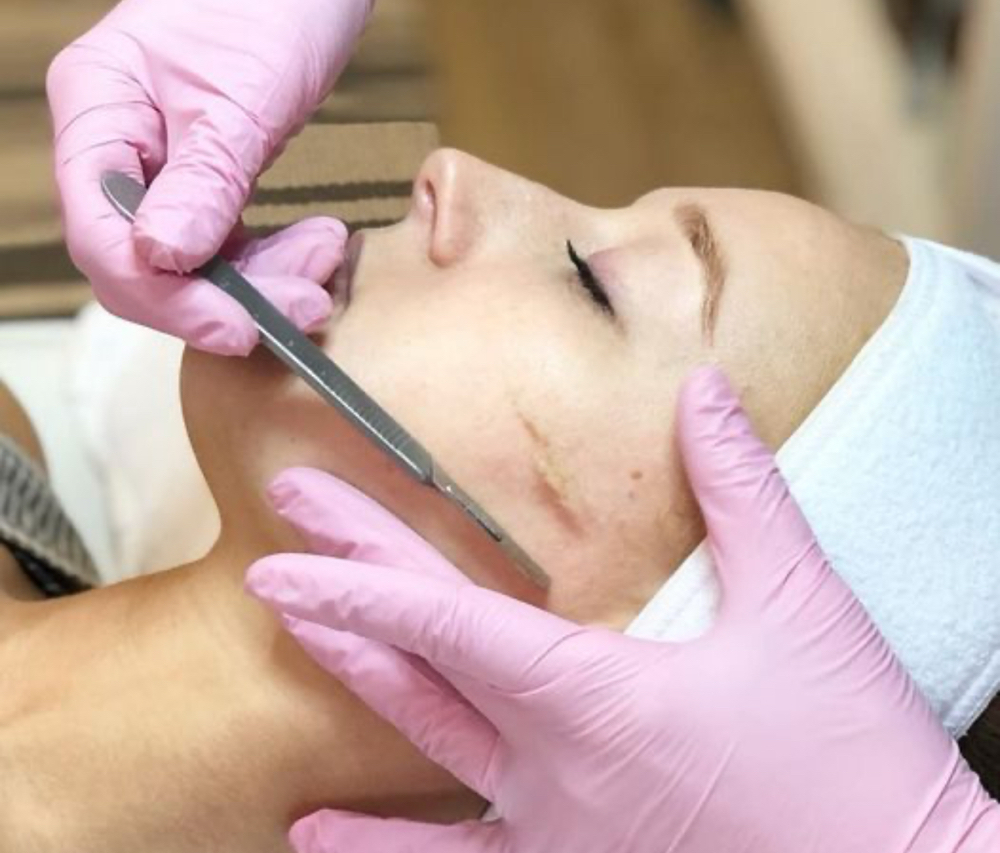 Dermaplane Facial