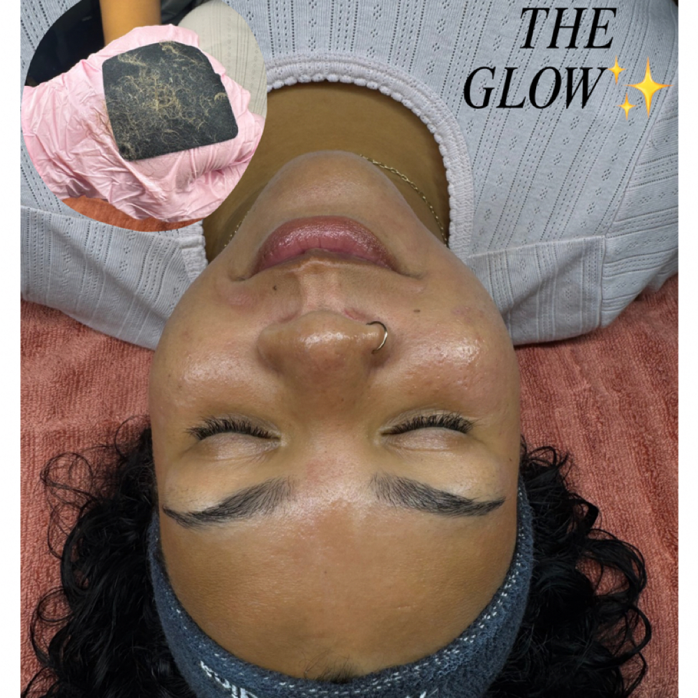 Dermaplane facial at SKN HAVEN in Fort Wayne, IN