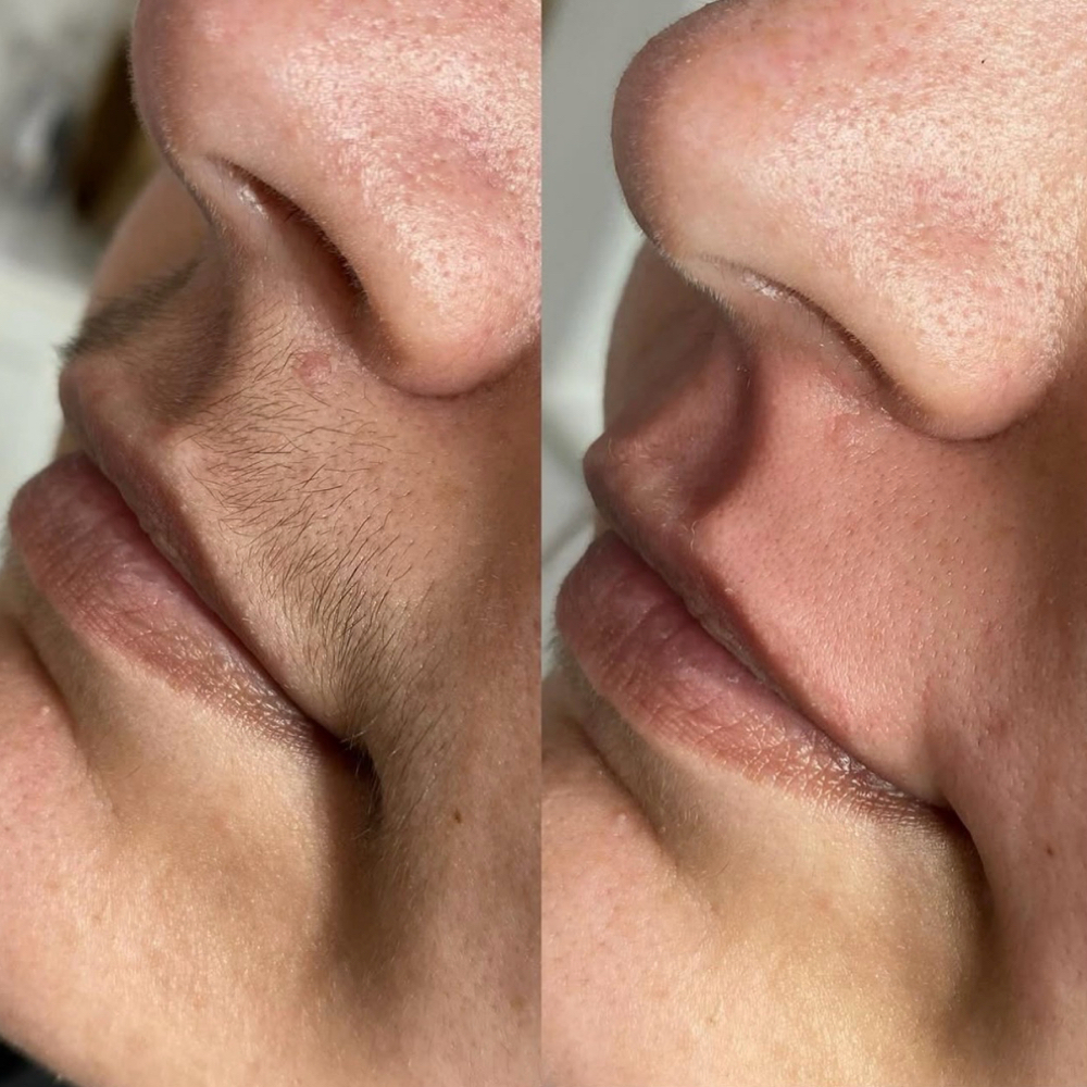 Upper Lip Wax at Blessed Beauty Aesthetics, LLC in Houston, TX