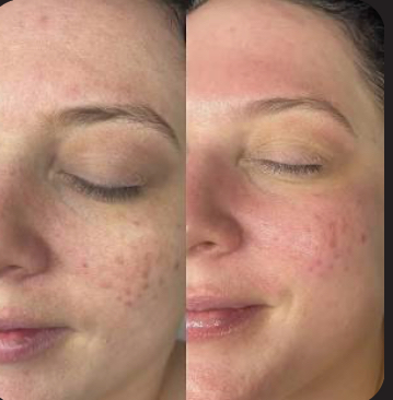 Express Facial