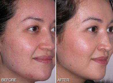 Diamond Radiance & Repair Facial