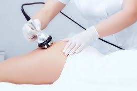 Radiofrequency Skin Tightening