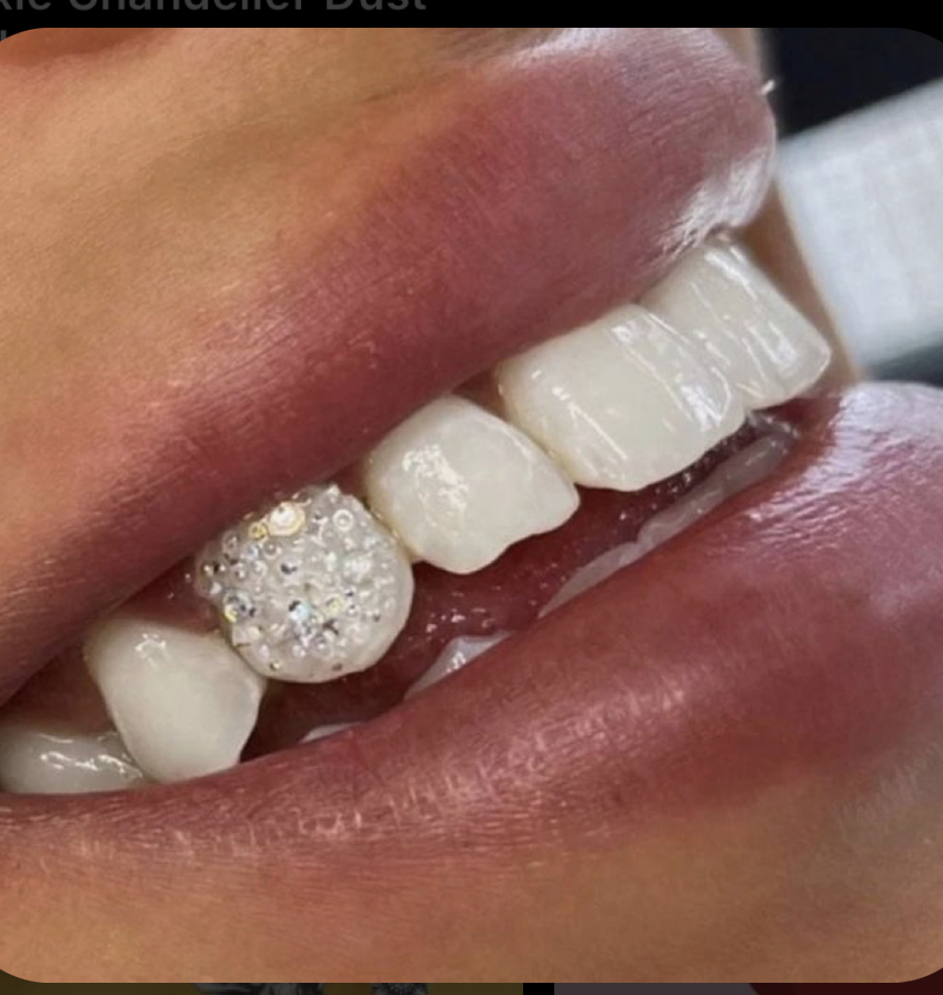 Disco Tooth Gem