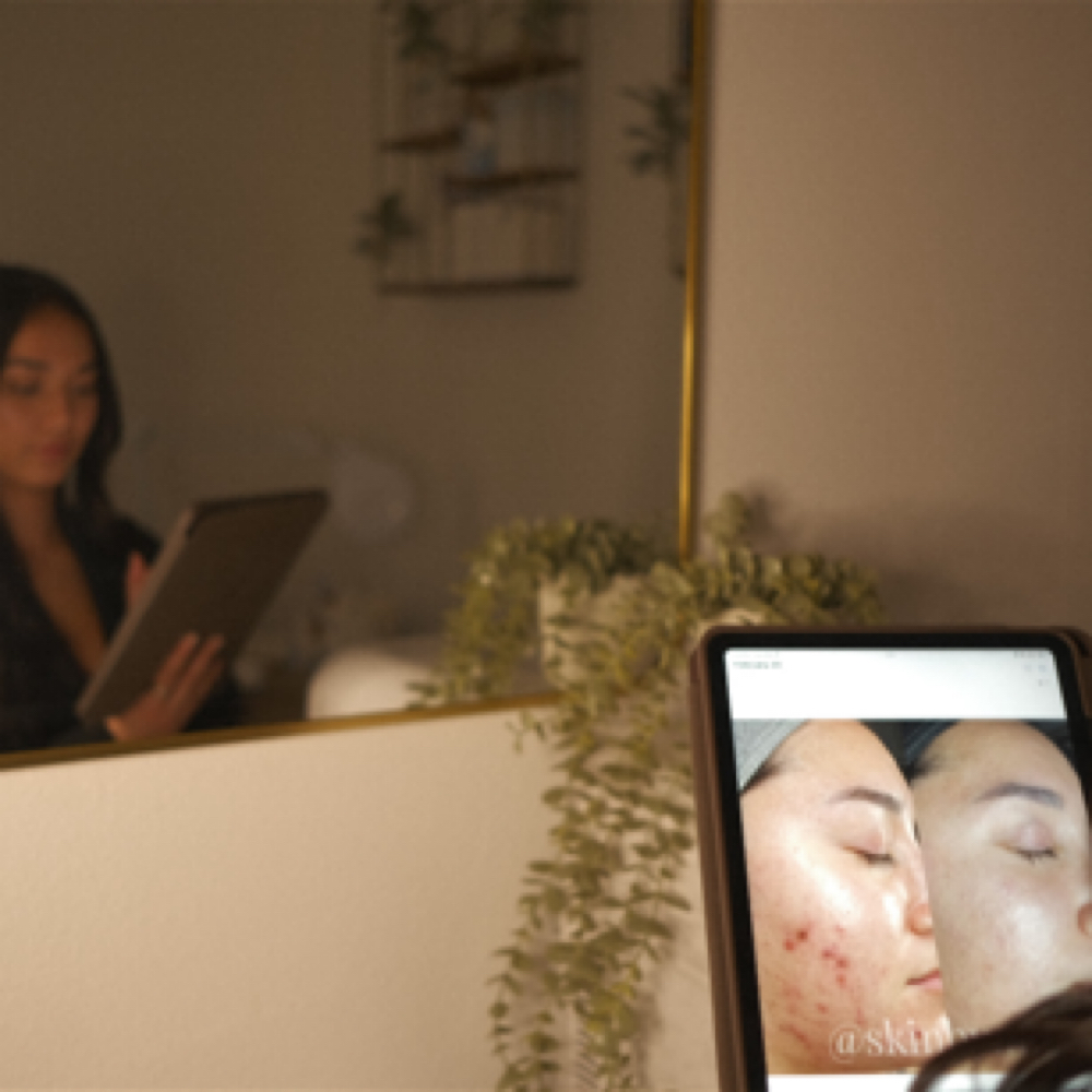 Virtual Skin Consultation