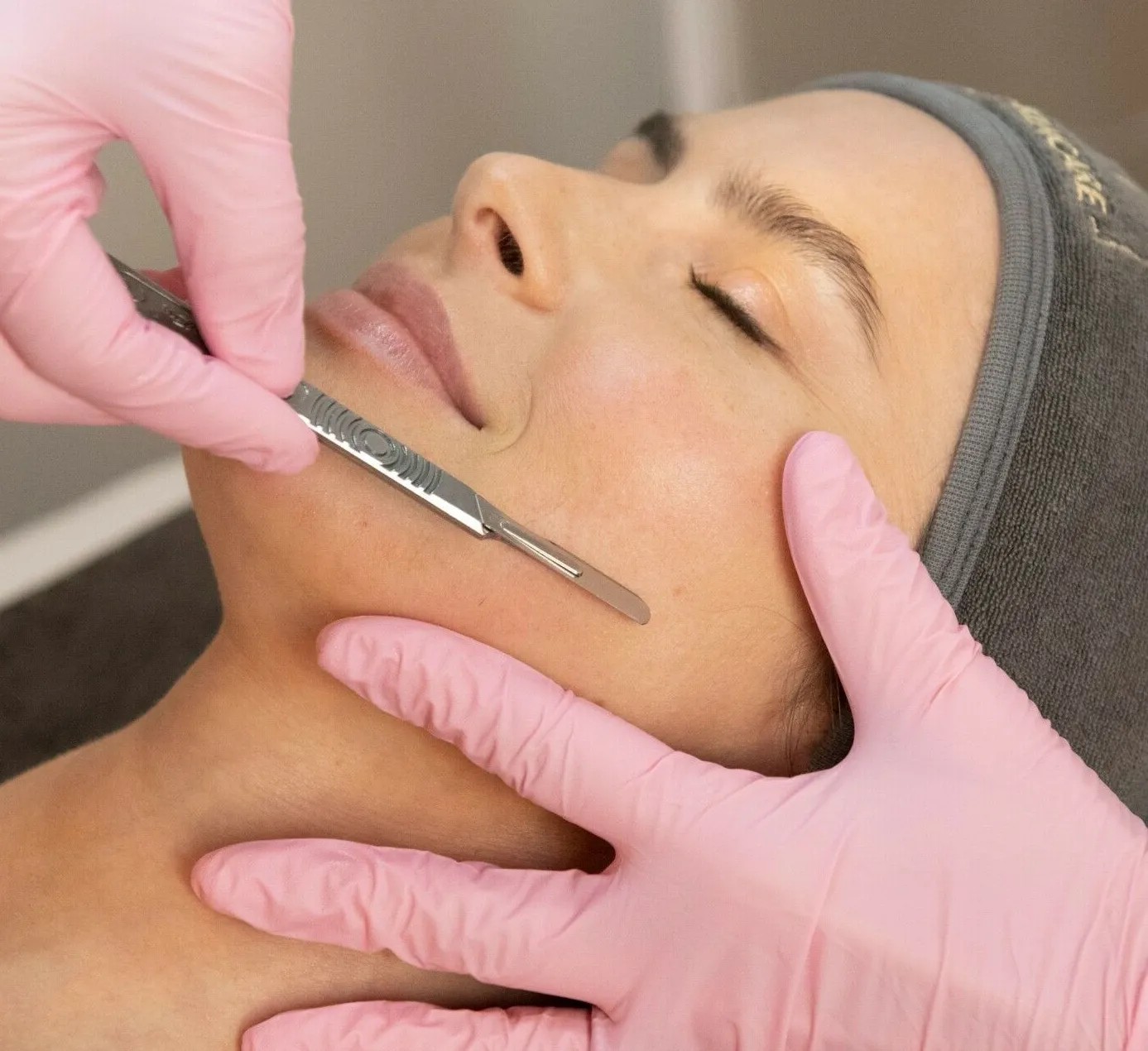 Dermaplaning