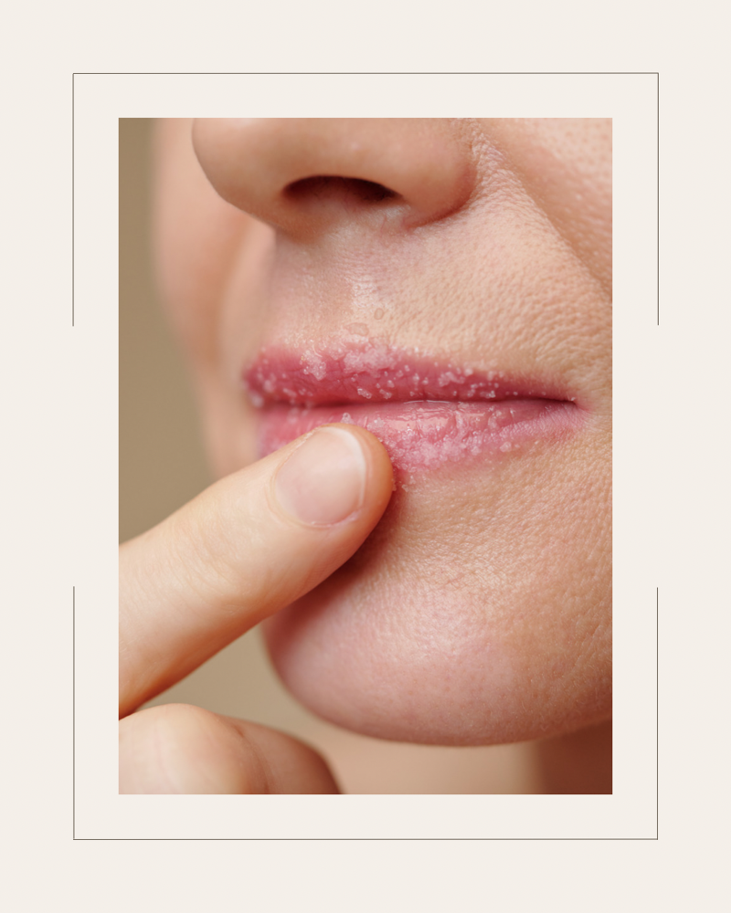Lip Exfoliation And Hydration