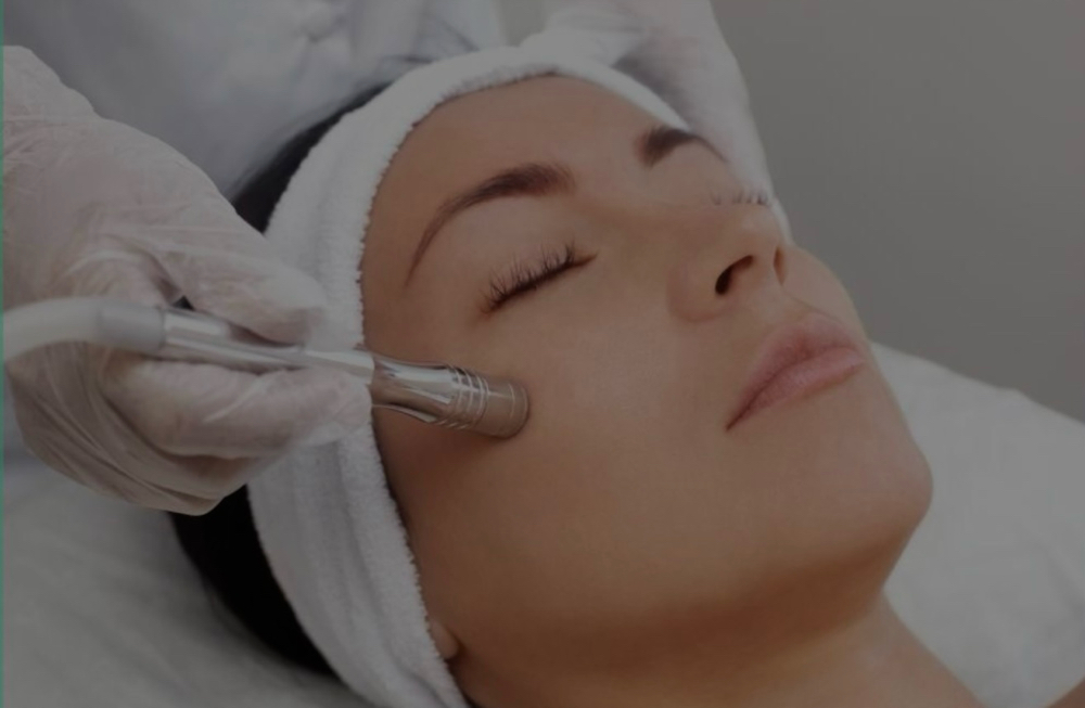 Microdermasion
