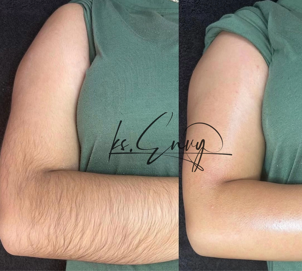 Arms (Full) at KS.Envy in Columbus, OH