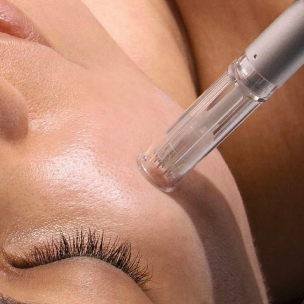 Nano Infusion (Add-On) at Glow Muse Studio in Arlington, TX