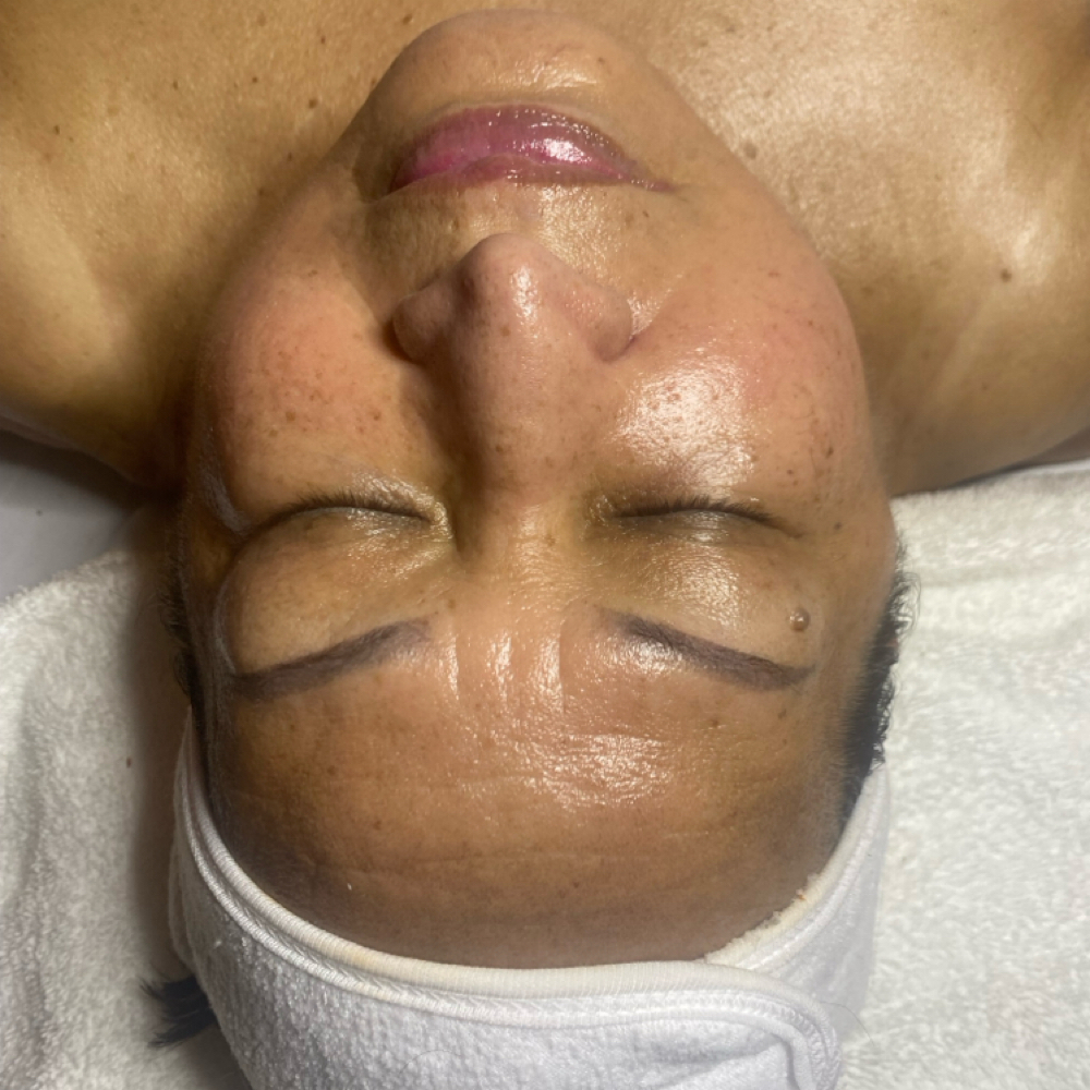 Ultimate A hydration Facial at Ruthy Spa in Lakewood, NJ