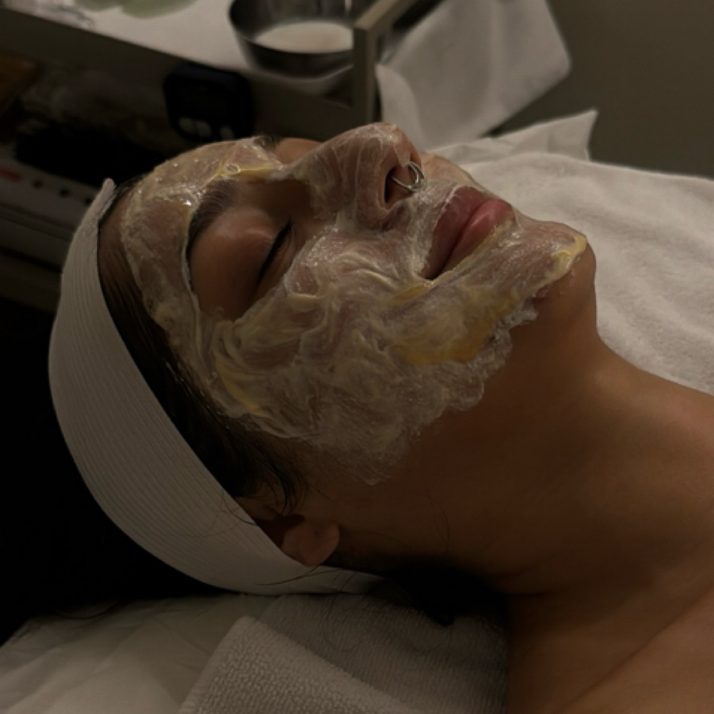 Signature Ezyme Chemical Peel at Beautifully Esthetics in Costa Mesa, CA