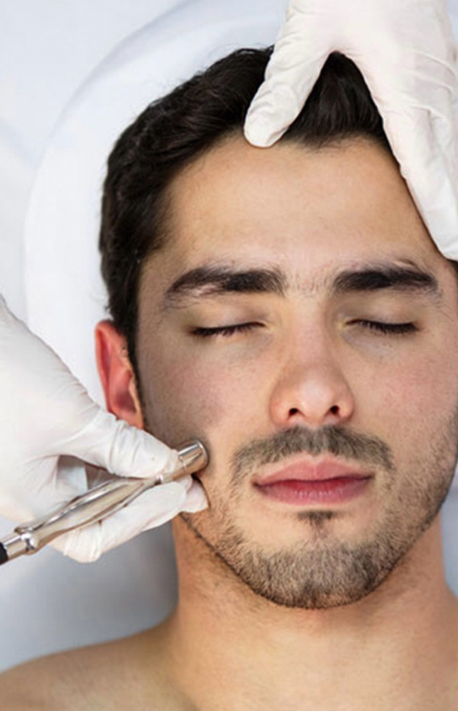 Microdermabrasion Facial