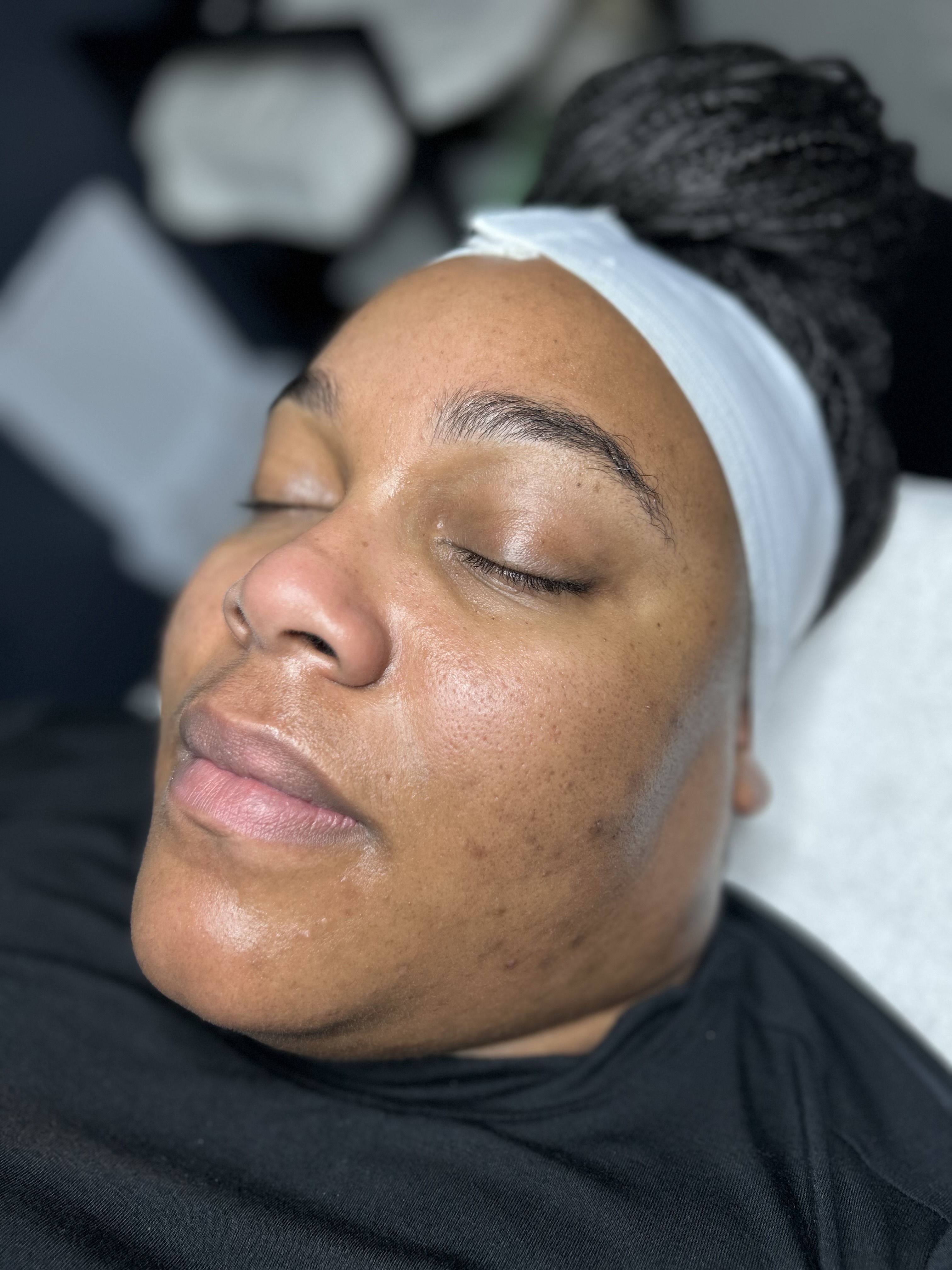 Glow-Boosting Package (4 Facials)