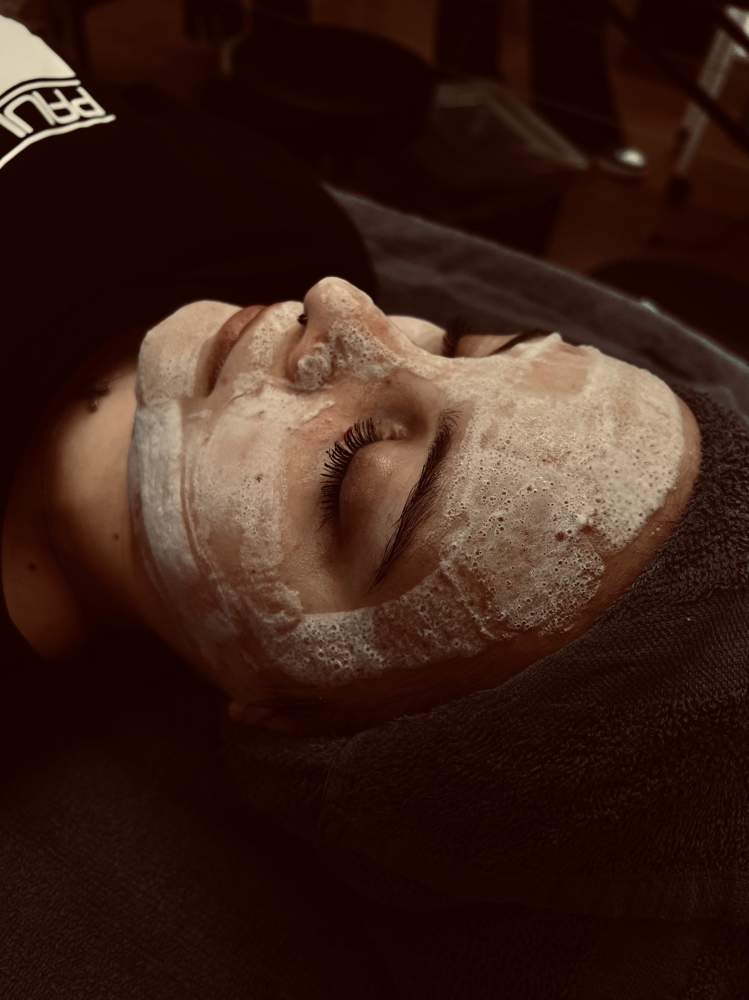 Chemical Peel