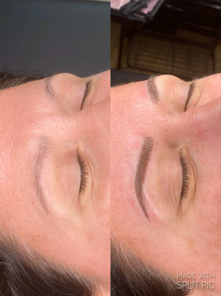 Combination Brow