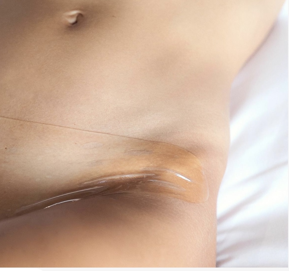Hydrogel Vajacial Brazilian Add On