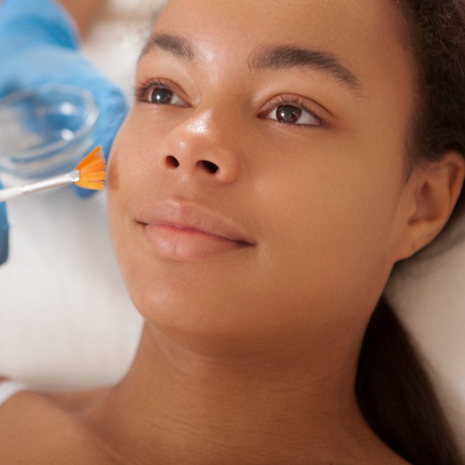 Chemical Peel Treatment at The Rejuvenation Suite Med Spa in New Rochelle, NY