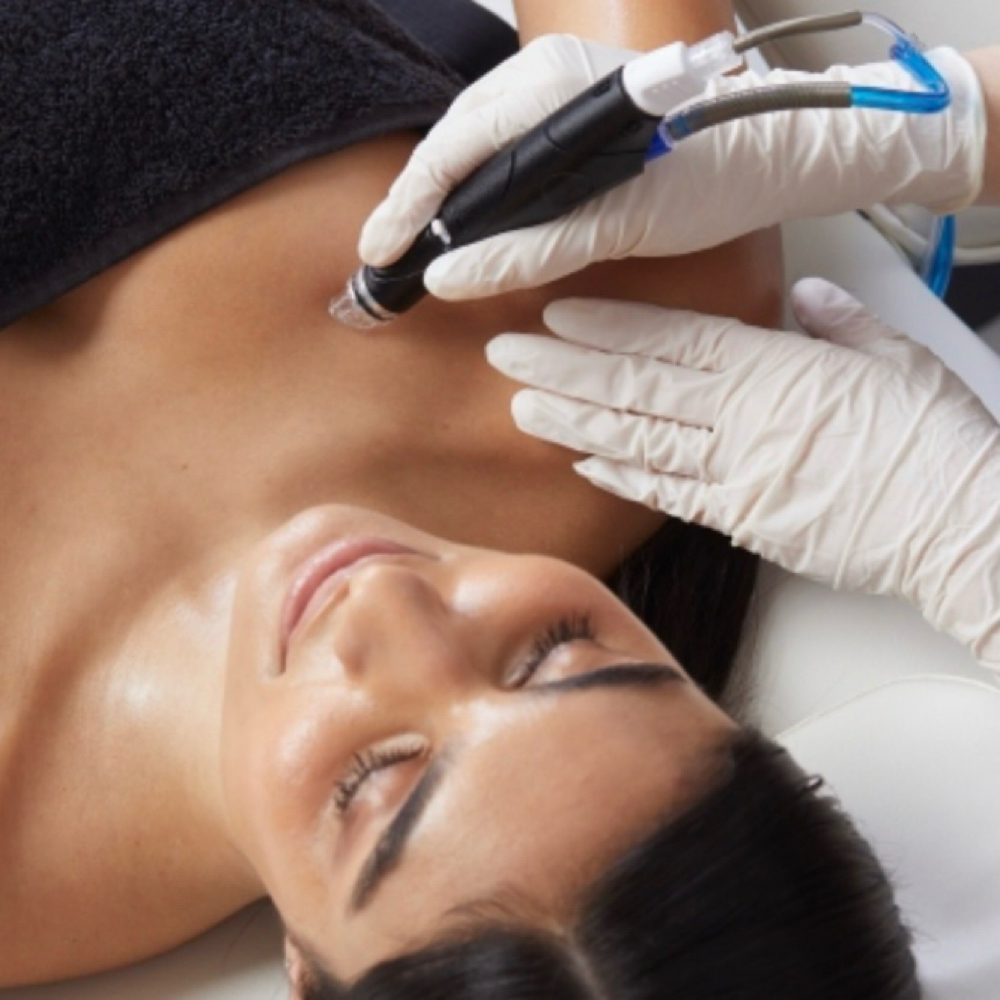 Hydrafacial Neck & Décolleté at SKIN by Christine Russell in Green Bay, WI