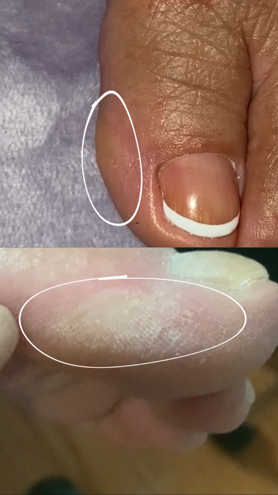 Dry Callus Removal Add On