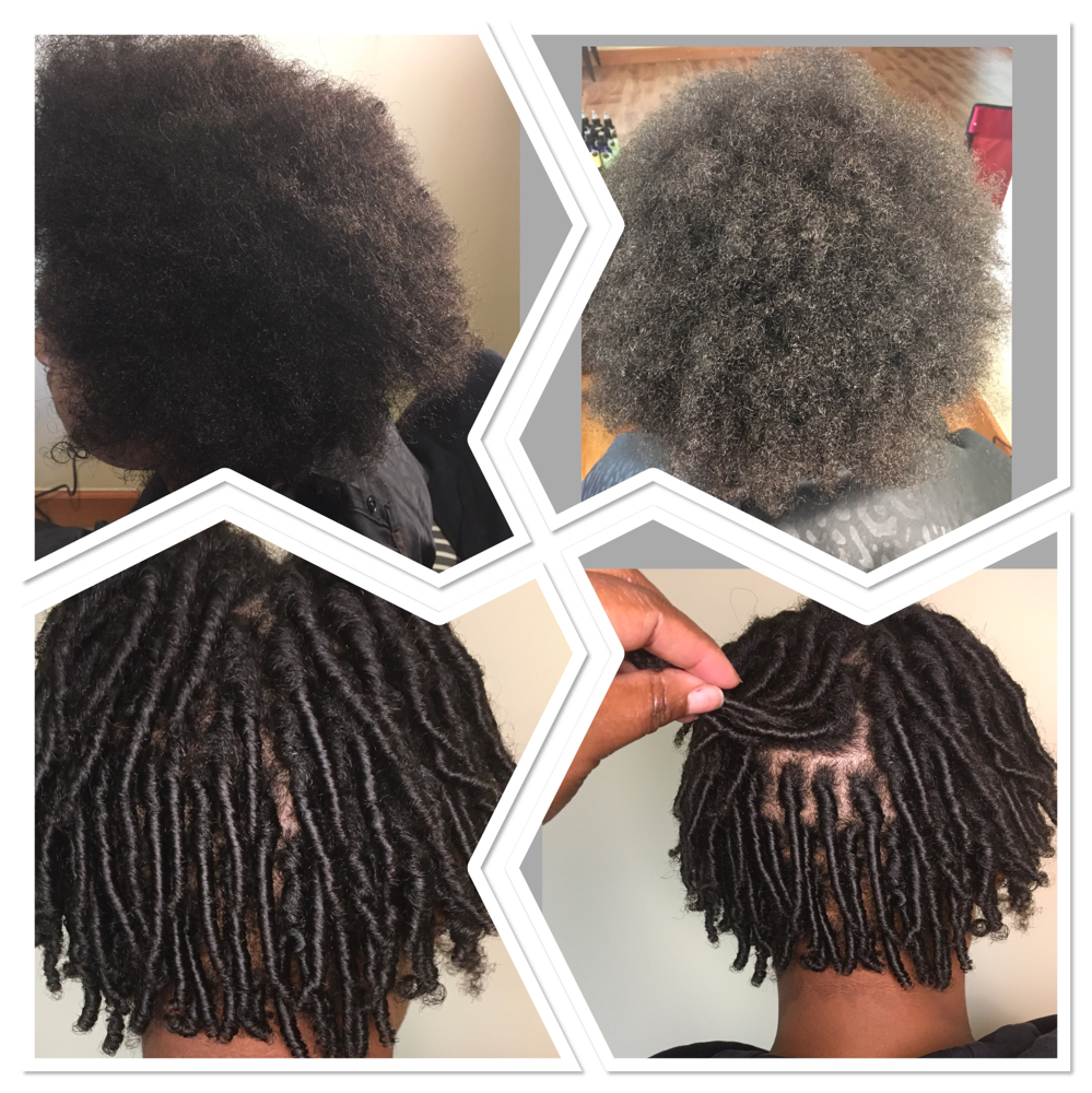 Starter Locs Trad.(Consult. Req)