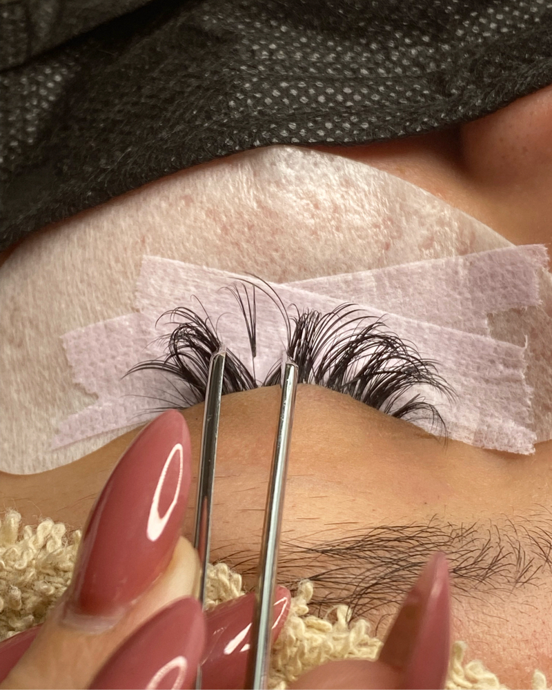 LASH | Removal