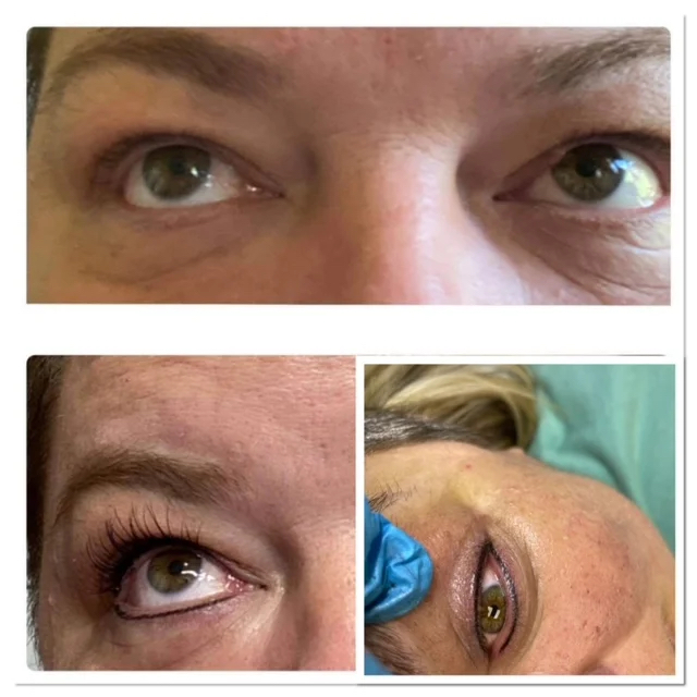 Eye Liner Tattoo Micropigmentation