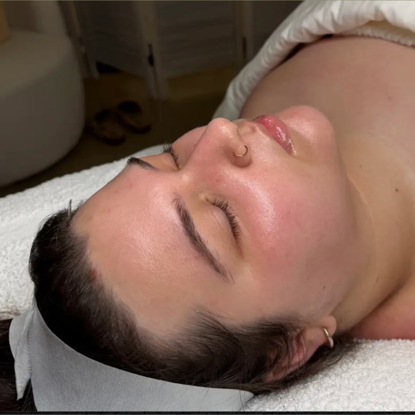 Peel at Lola’s Skin Therapy in El Dorado Hills, CA
