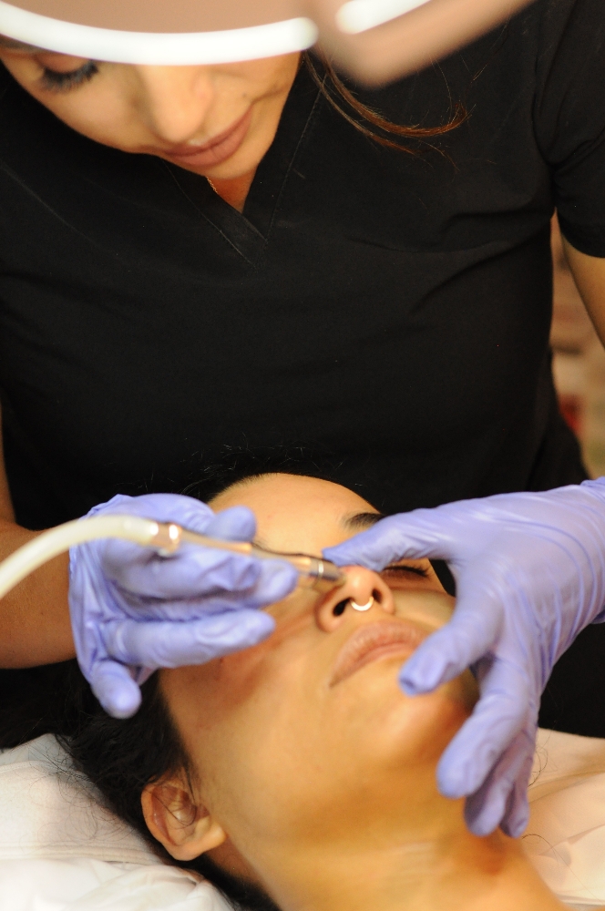 Microderm Facial