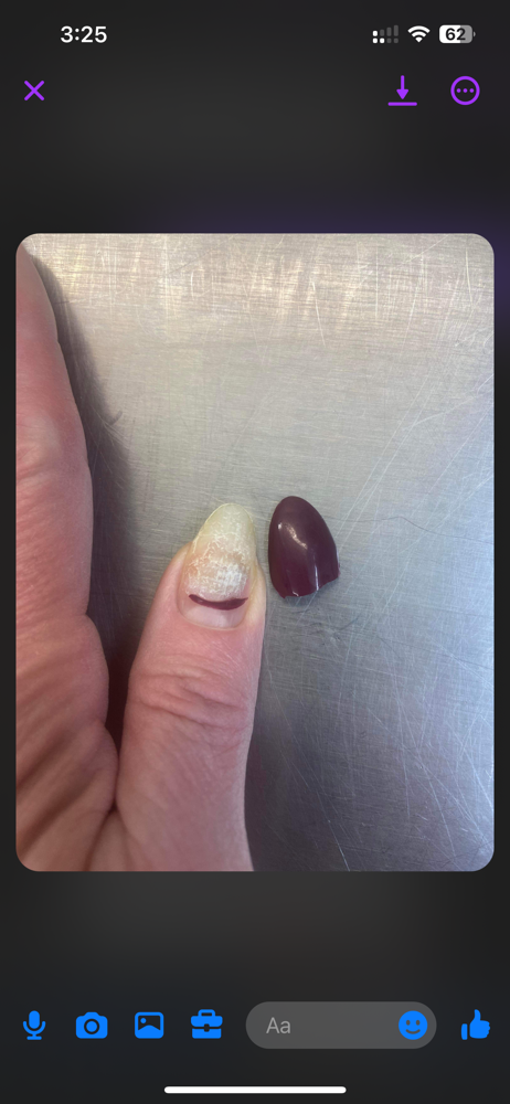 NAIL REPAIR