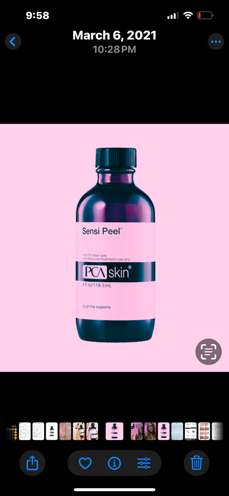 PCA Chemical peel