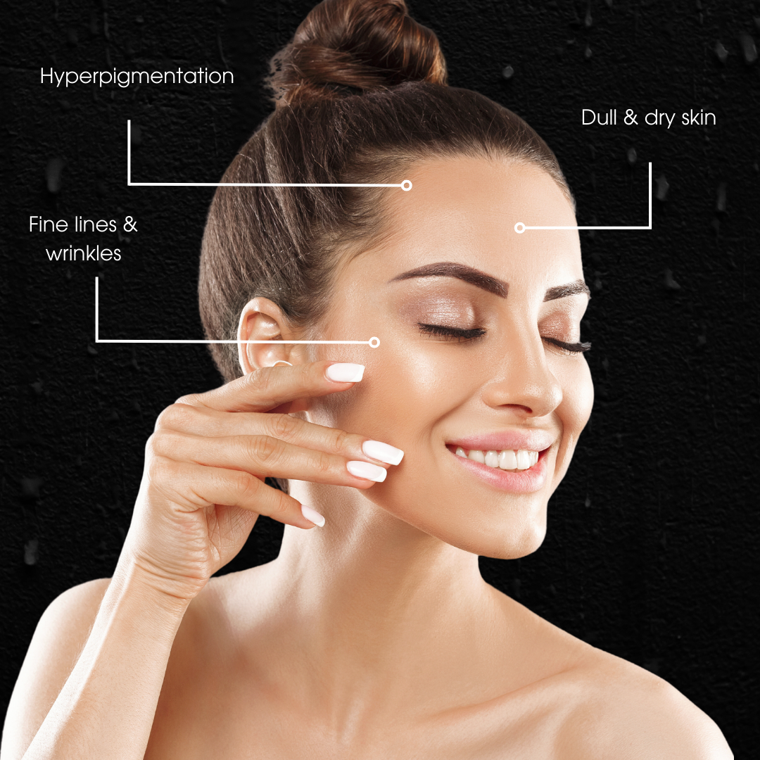 Facial + FREE Dermaplane