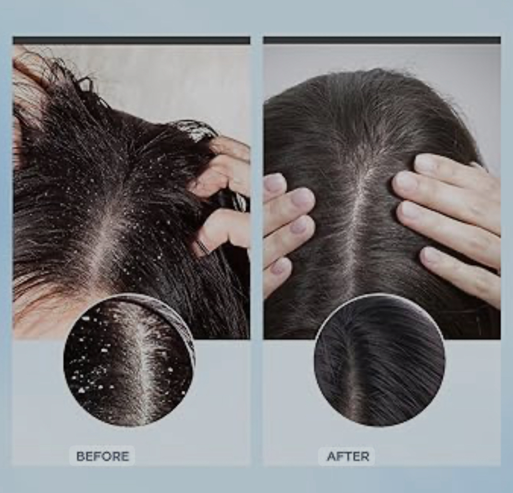 Scalp and Hair treatment at Holly Smith-Martinez at Beauty Within Lakeport in Lakeport, CA