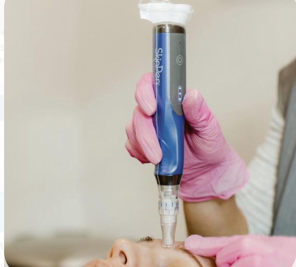 SkinPen Microneedling Package of 3