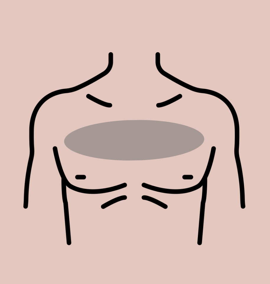 Chest Treatment
