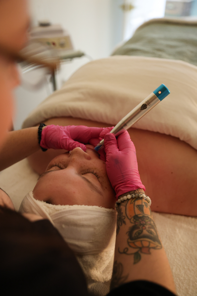 Hydrating Lip Renewal