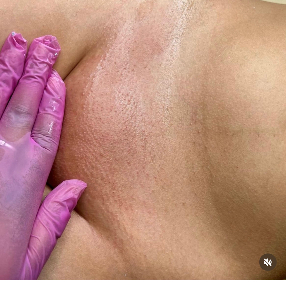 Brazilian Wax