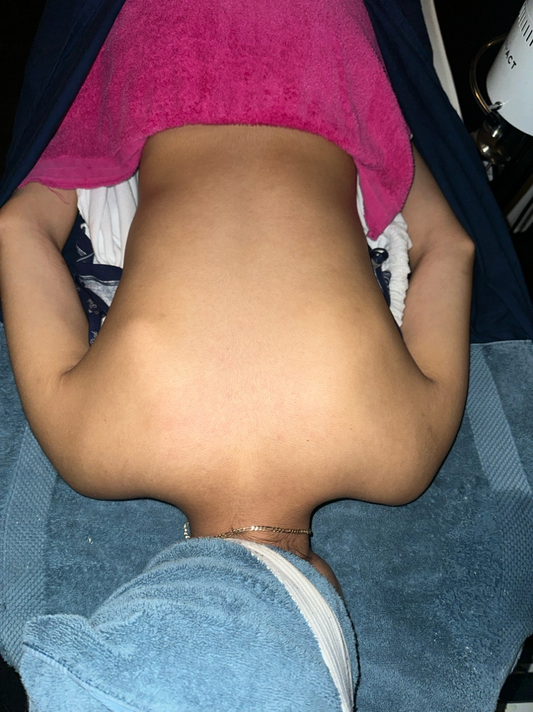 Back Facial