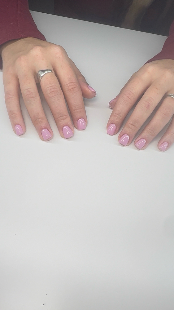 Gel fill