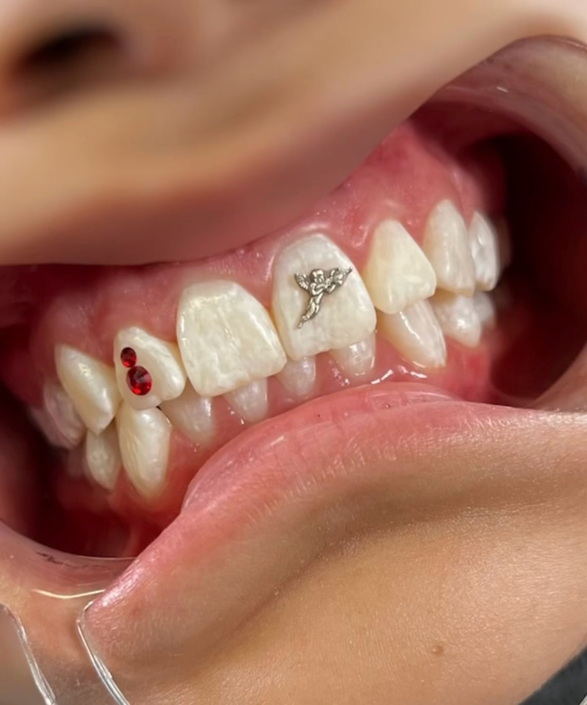 Tooth Gems