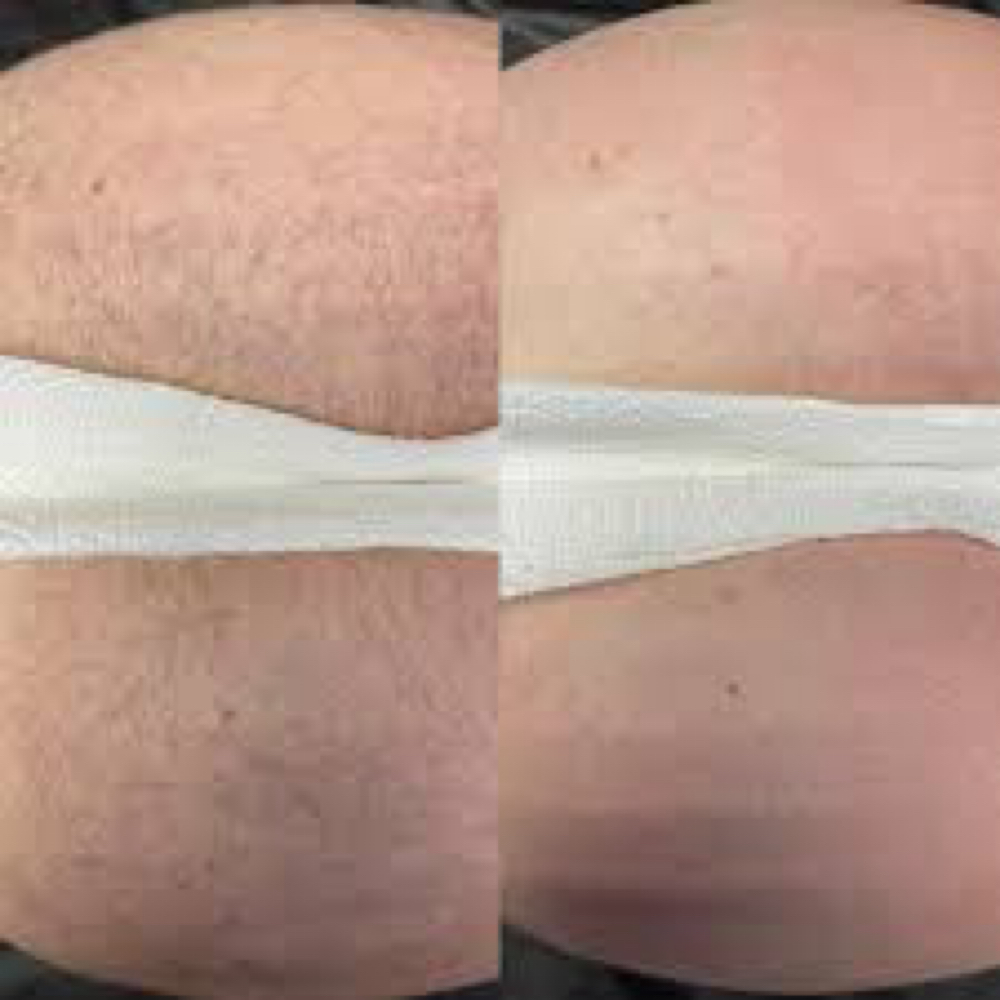 Full Butt Wax at Angelic Skin & Body in Oak Park, IL