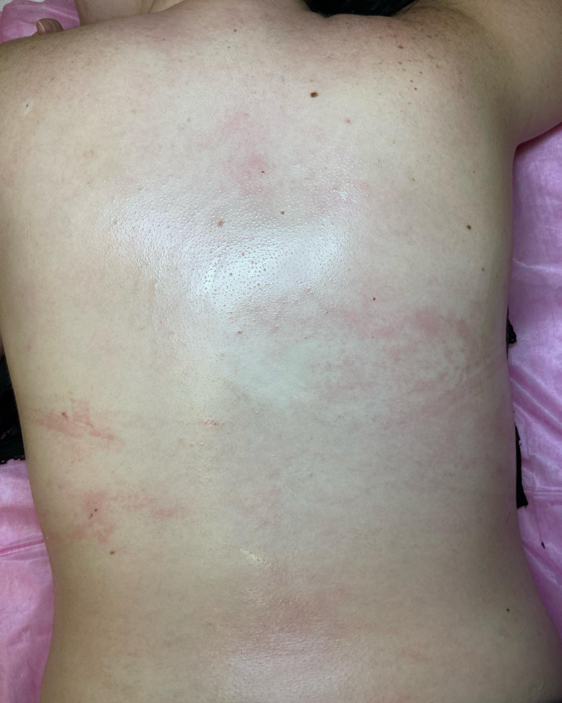 Back Wax