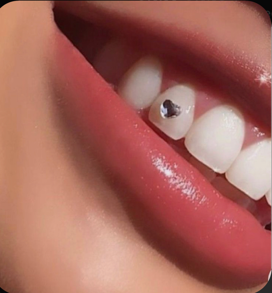 One Tooth Gem