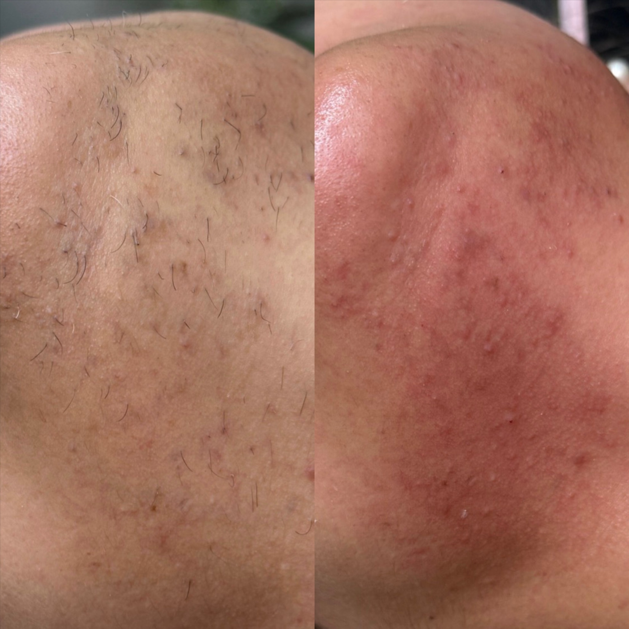 Chin Wax at Pink Crab Wax Bar in Las Vegas, NV